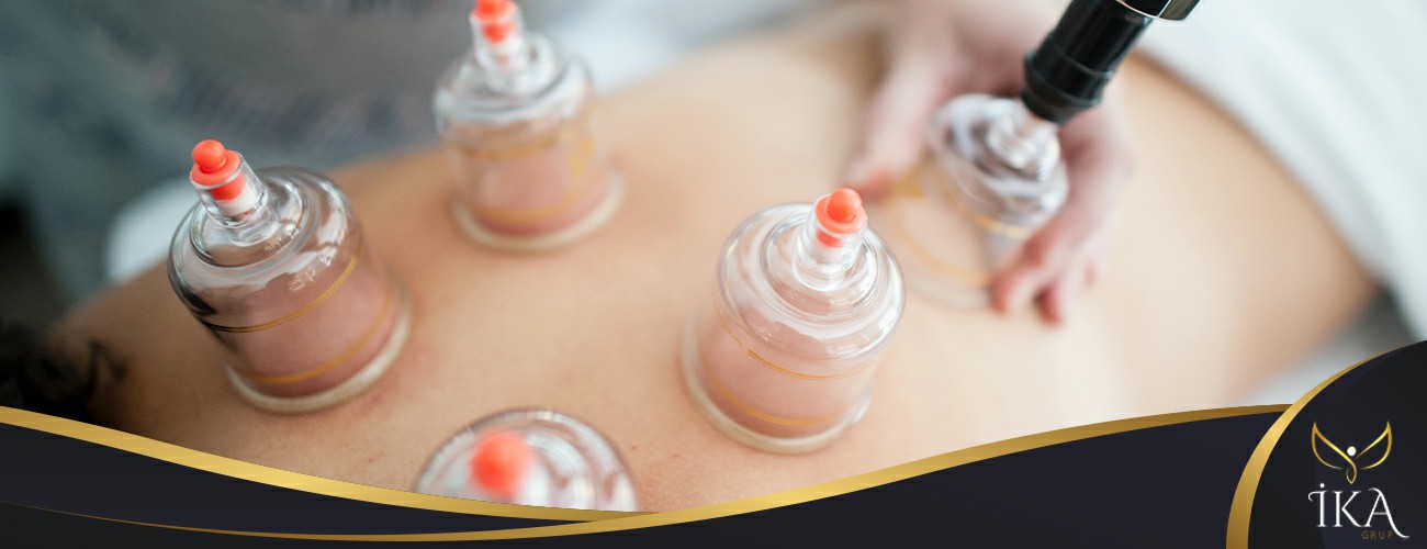 Cupping Masajı Tekirdağ